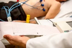 ECG Technician